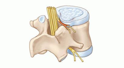 xẹp cột sống nguyên nhân và cách chưa