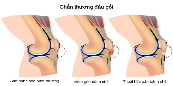 ton thuong gan banh che