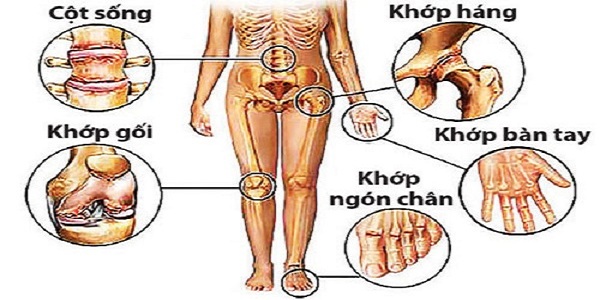 cac-khop-de-bi-thoai-hoa